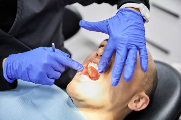 Best Knocked-Out Tooth Emergency  in Schaumburg, IL