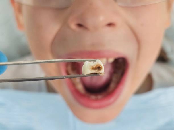 Best Broken Tooth Emergency  in Schaumburg, IL